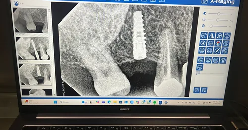 Dr. Jorge Arturo Cuevas | iDental Colima, consultorio dental en Colima, Colima