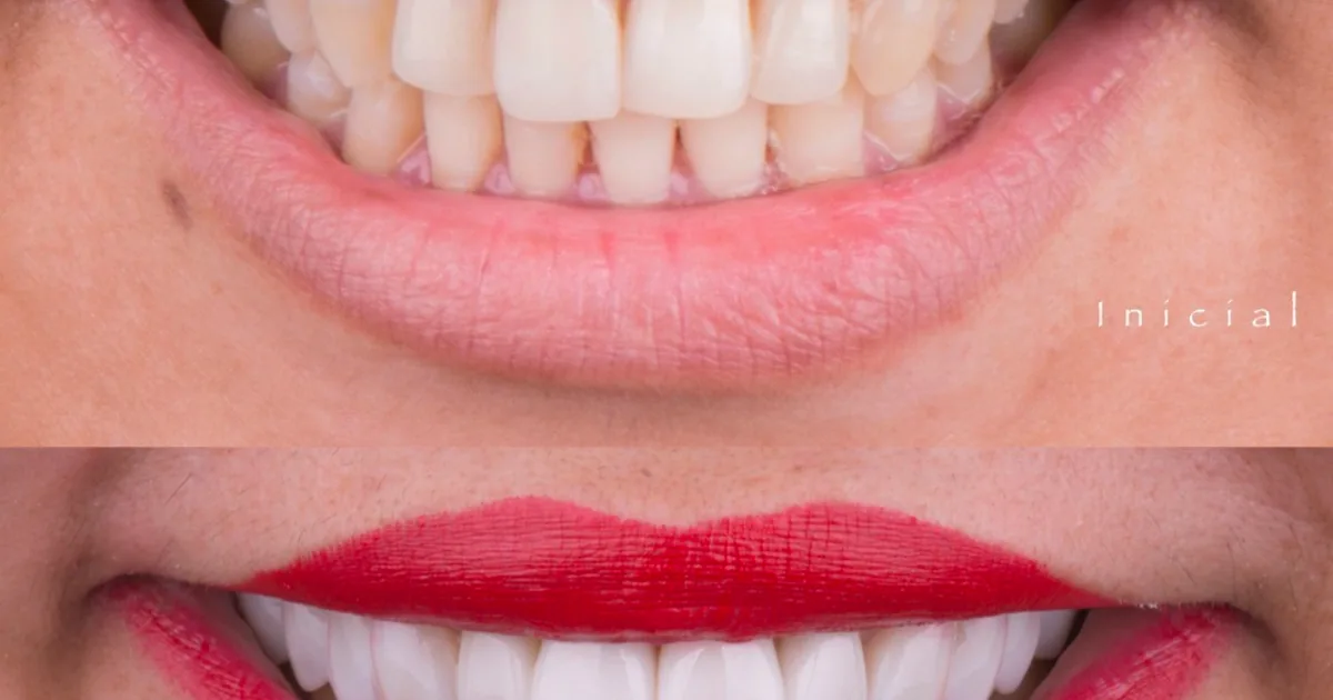 Dr. Jorge Arturo Cuevas | iDental Manzanillo