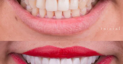 Dr. Jorge Arturo Cuevas | iDental Manzanillo, consultorio dental en Manzanillo, Colima