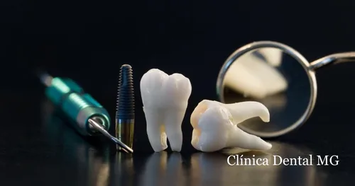 Clinica Dental mg Celaya, consultorio dental en Celaya, Guanajuato