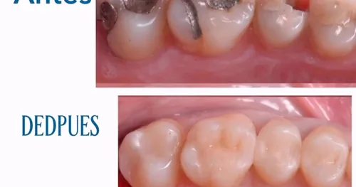 Clínica Dental FARA DENT Urgencias Dentales 24 horas, Dentista a Domicilio en León, Guanajuato, consultorio dental en León, Guanajuato