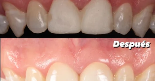 DENTISTAS- CLINK! DENTAL STUDIO, consultorio dental en León, Guanajuato