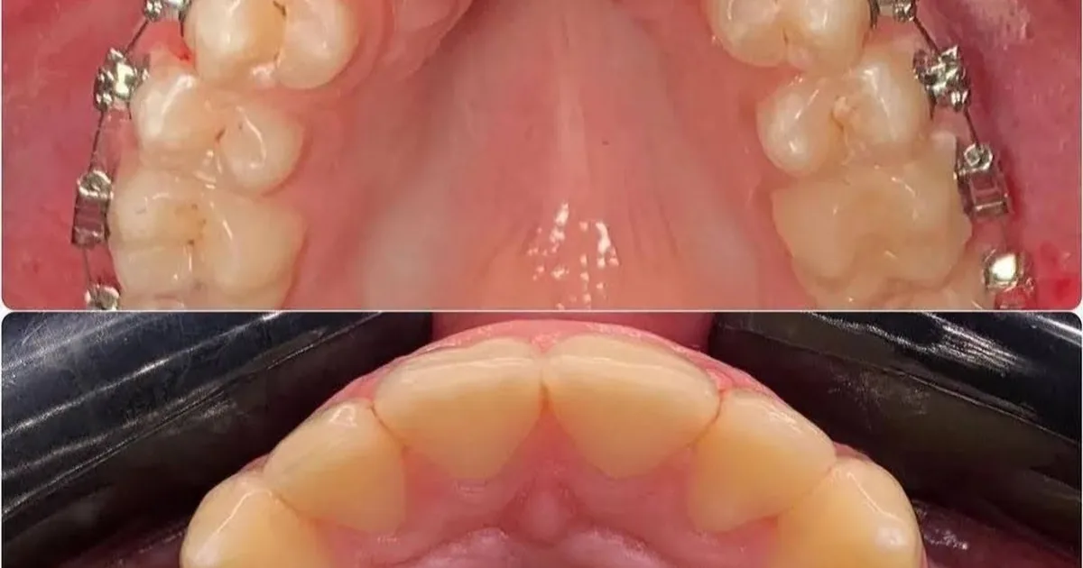 Oral Dental