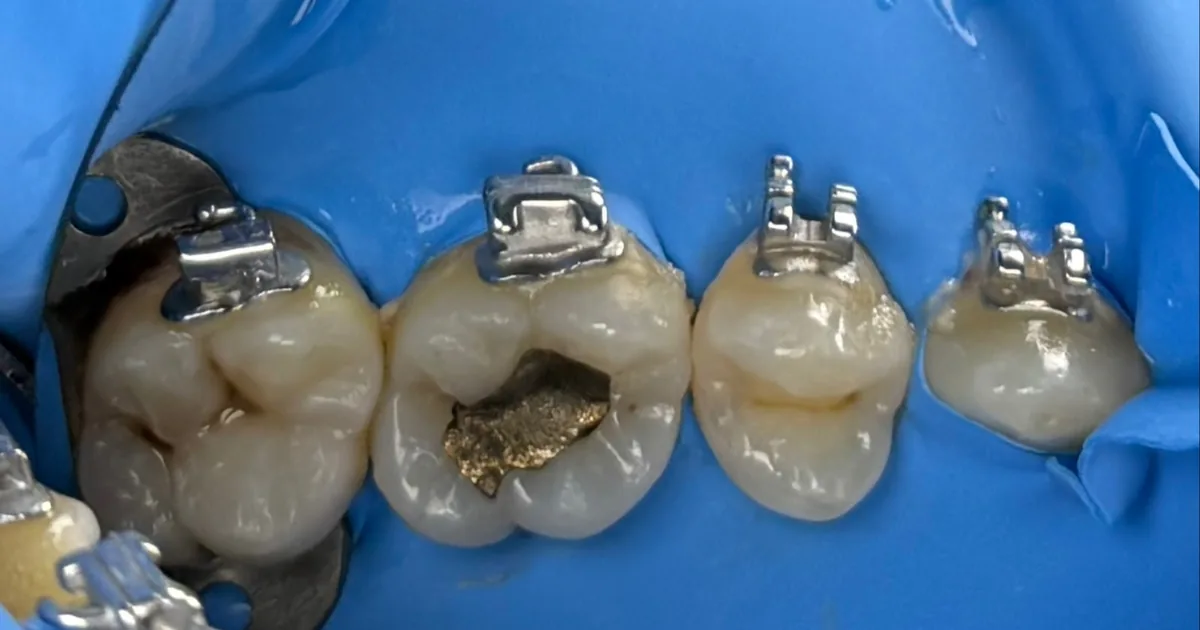 Dentista – Dr. Edwin Ramirez – Ortodoncia