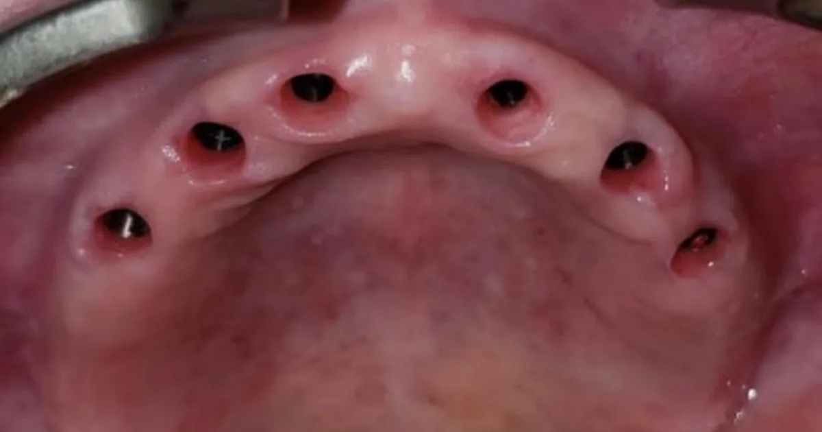Dr. Alfonso Gonzalez Ocaranza, Dentista – Odontólogo