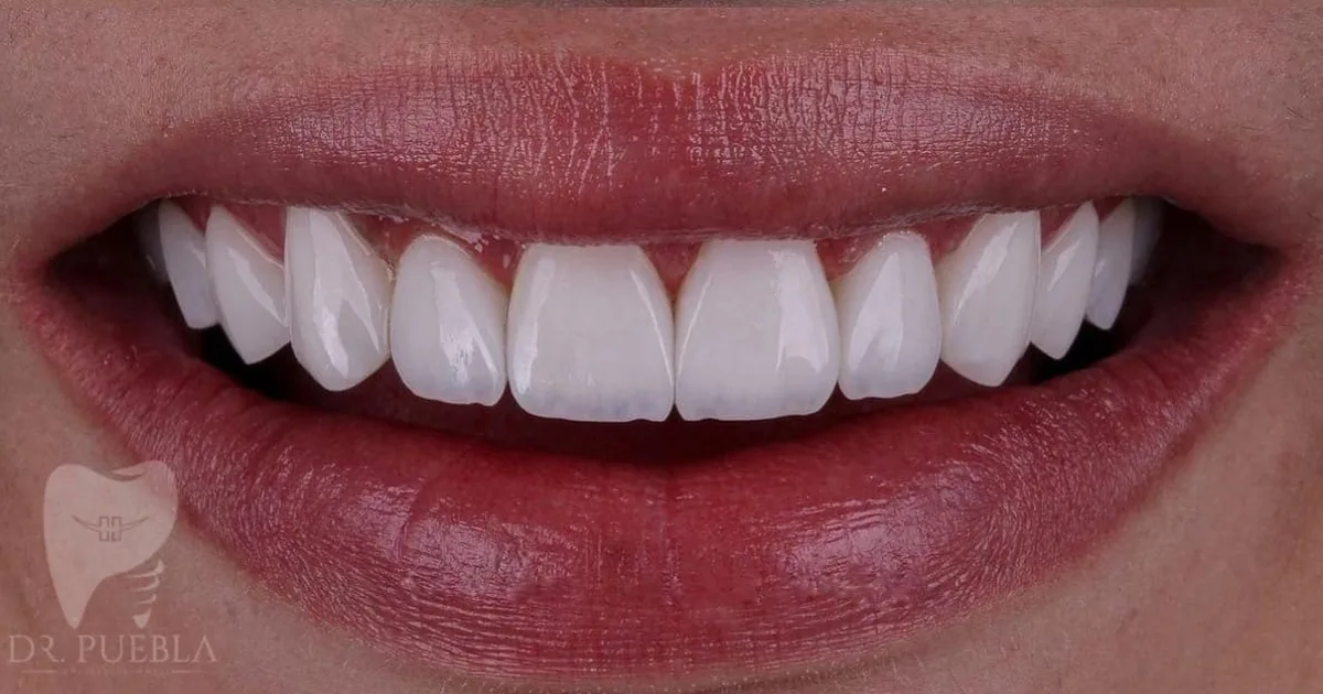 Consultorio Dental Dr. Puebla