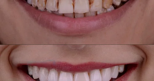 Dr. José Francisco Del Real García, Dentista – Odontólogo, consultorio dental en Zapopan, Jalisco
