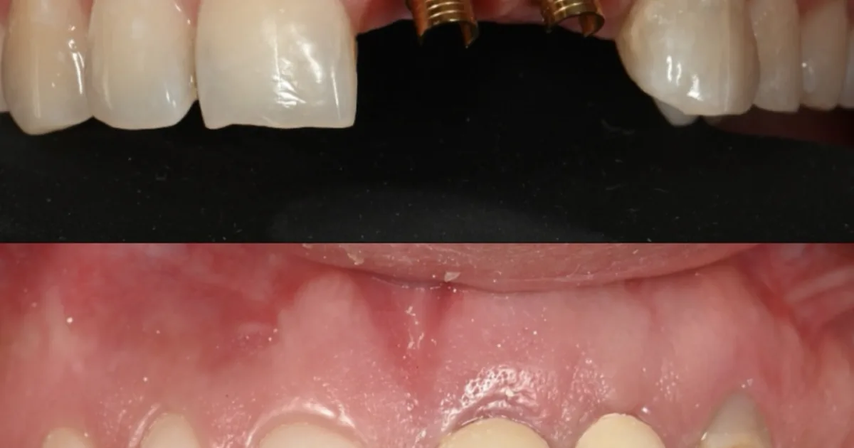 Dental Familiar