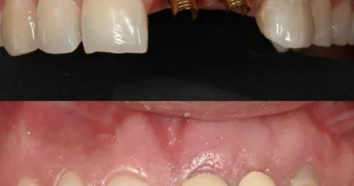 Dental Familiar, consultorio dental en Zapopan, Jalisco