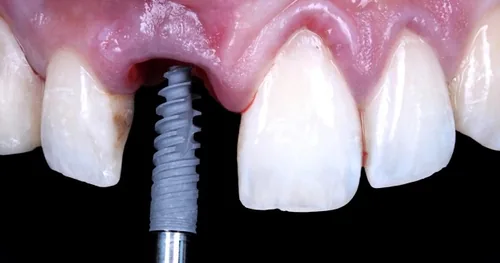 Consultorio Dental López & Mejorada, consultorio dental en Zapopan, Jalisco
