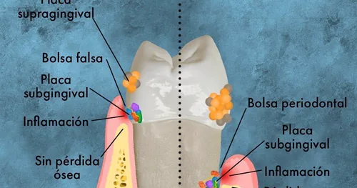 MayorDent, consultorio dental en Tlaquepaque, Jalisco