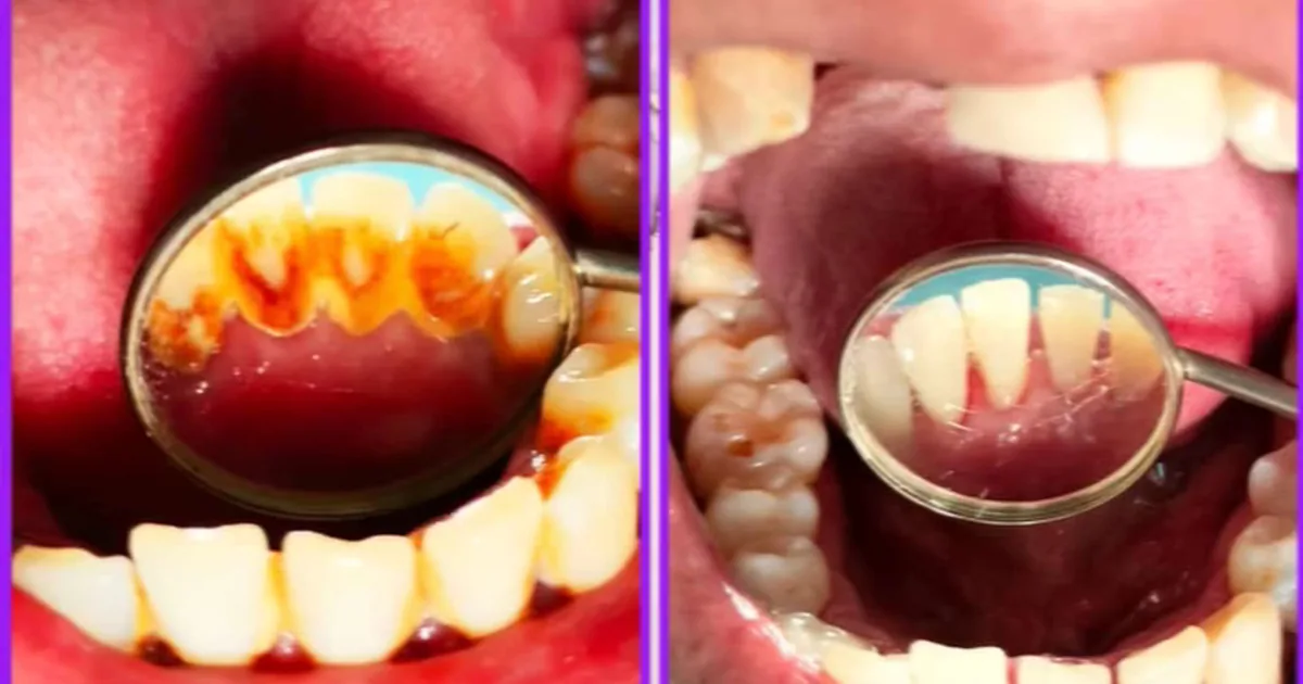 Clínica Dental Del Ángel