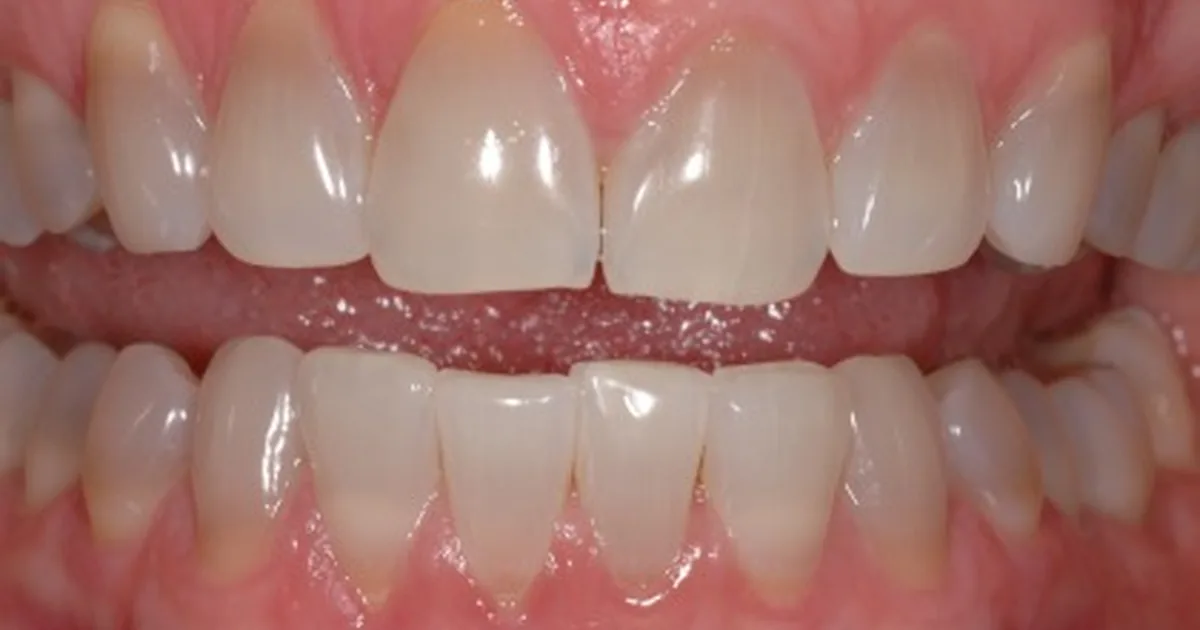 International Dental Center PV Cosmetic Dentistry and Dental Implants