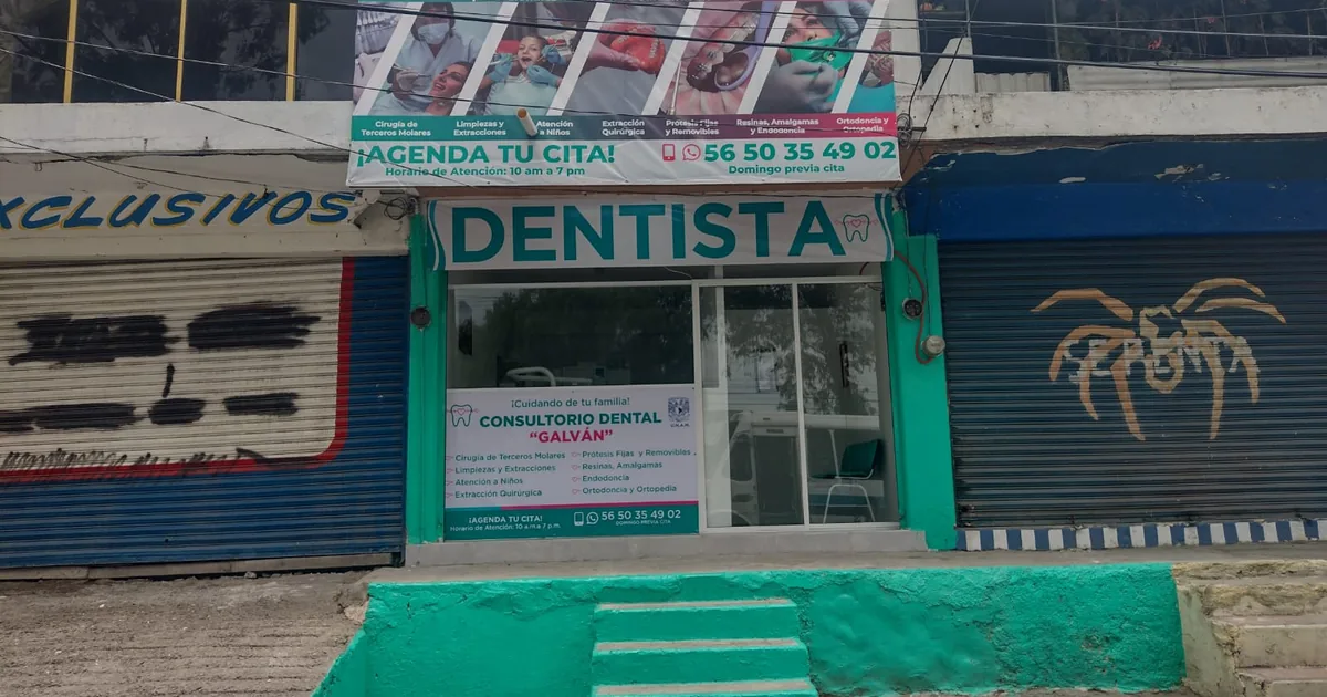 Dentista Ixtapaluca – Consultorio Dental «Galdent»