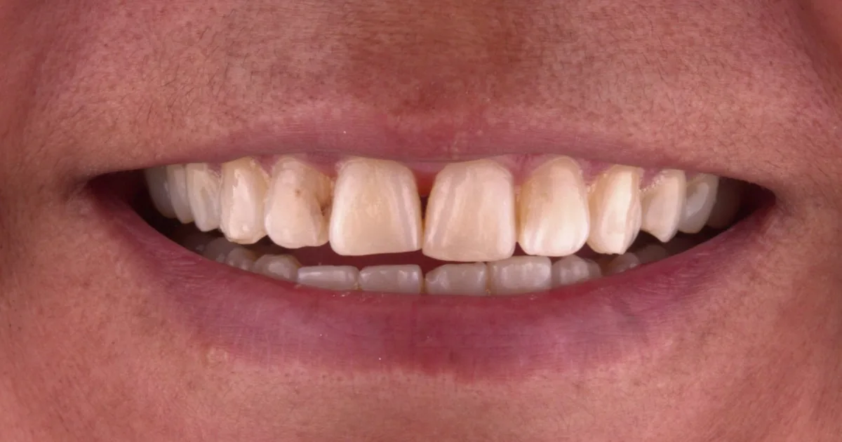 Consultorio Dental | G&G Arte Dental Ixtapaluca