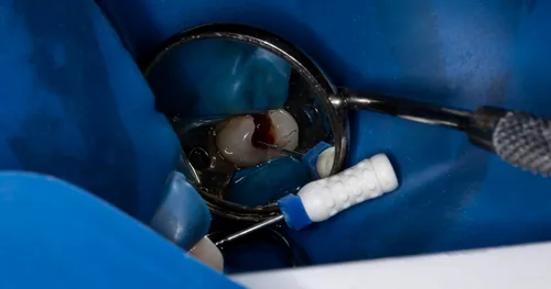 Clínica Dental BF, consultorio dental en Ixtapaluca, Estado de México