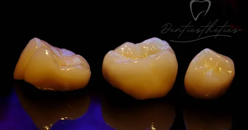 Dentiesthetics, consultorio dental en Ecatepec de Morelos, Estado de México