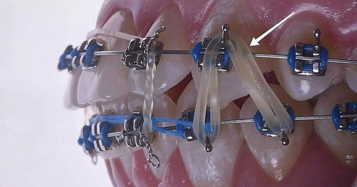 DENTALI-k