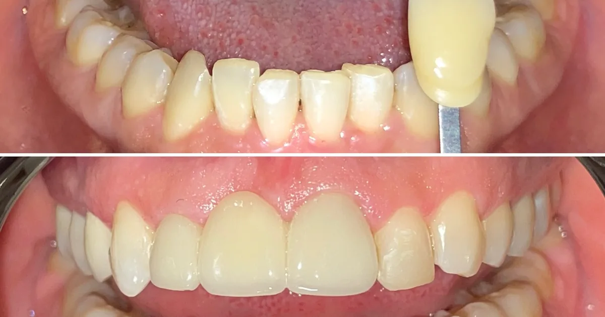 Dental inn Tecámac