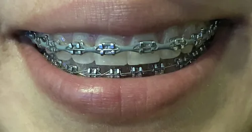 Dental Del Parque, consultorio dental en Coacalco de Berriozábal, Estado de México