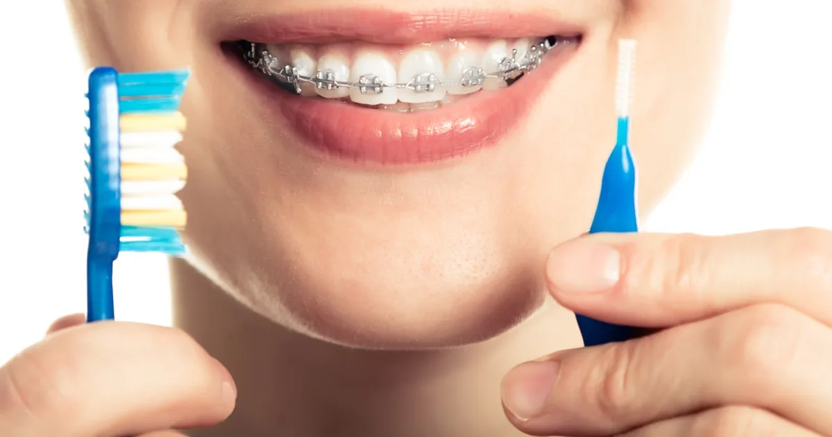 Clínica Dental Coacalco Dentista – Ortodoncia