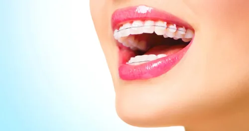Jack´s Smile Dental Studio Dentista en Coacalco, consultorio dental en Coacalco de Berriozábal, Estado de México