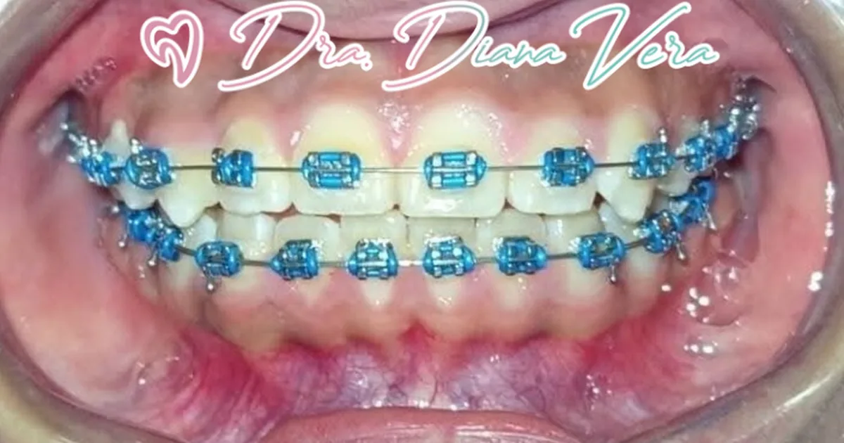 Dental Inn – Nezahualcoyotl