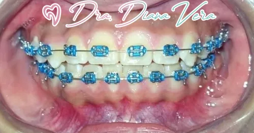 Dental Inn – Nezahualcoyotl, consultorio dental en Nezahualcóyotl, Estado de México