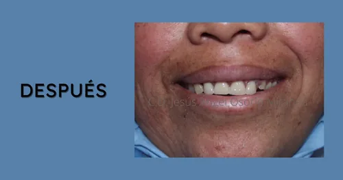 OSMOS Odontología de calidad a tu servicio, consultorio dental en Nicolás Romero, Estado de México