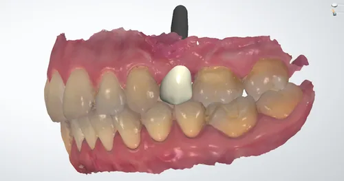 Dental Health MX, consultorio dental en Tlalnepantla, Estado de México