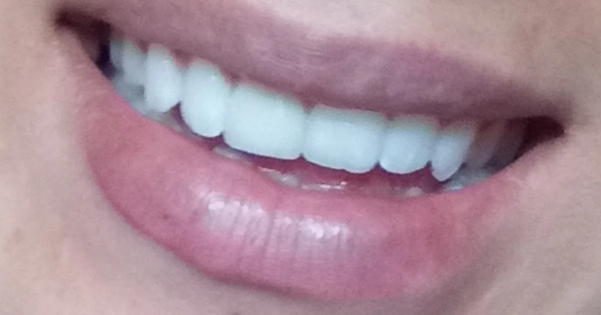 DENTAL PREMIER