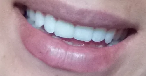 DENTAL PREMIER, consultorio dental en Atizapán de Zaragoza, Estado de México