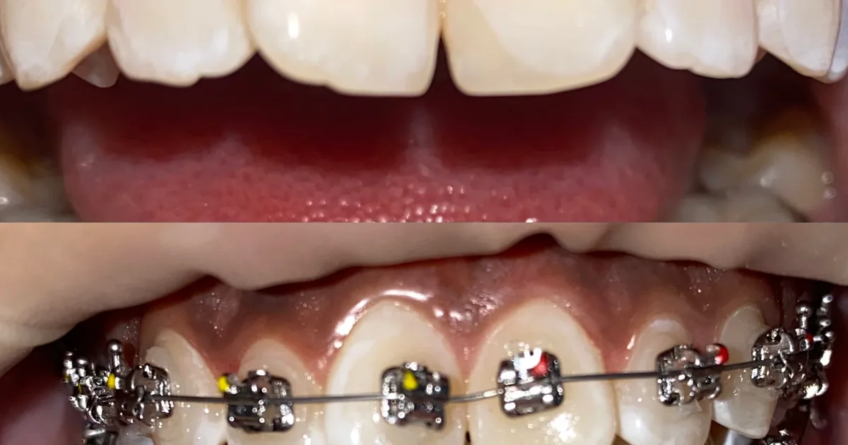 dentalia Galerías Atizapan
