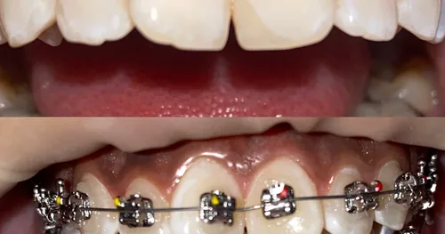dentalia Galerías Atizapan, consultorio dental en Atizapán de Zaragoza, Estado de México