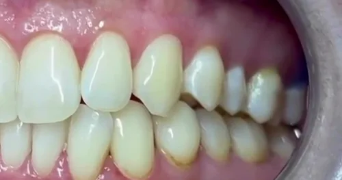 Luav Dental Center Dentistas, consultorio dental en Atizapán de Zaragoza, Estado de México