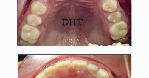 DENTAL HEALTH TEXCOCO, consultorio dental en Texcoco, Estado de México