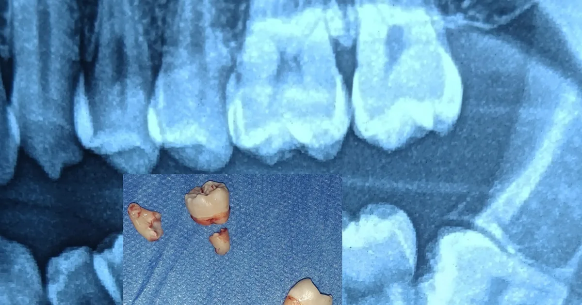Dentista Adán Zamora ( Consultorio Dental Zamora )