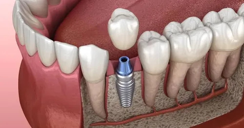 Dental Emporio, consultorio dental en Tultepec, Estado de México