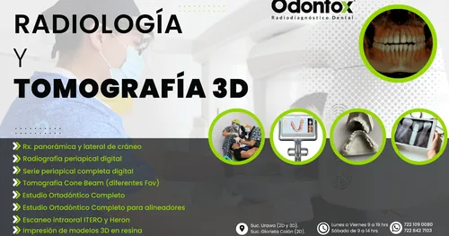 Odontox Glorieta Colón, consultorio dental en Toluca, Estado de México