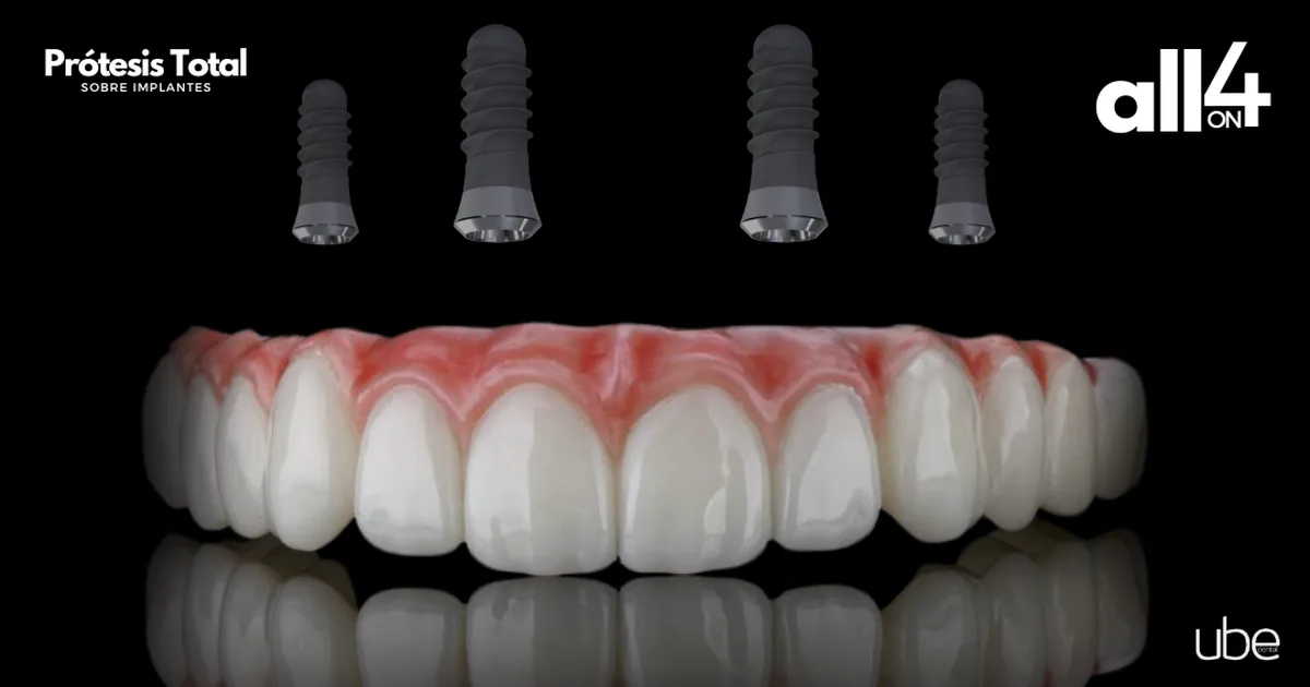 Ube Dental Pabellón Metepec – Dentistas