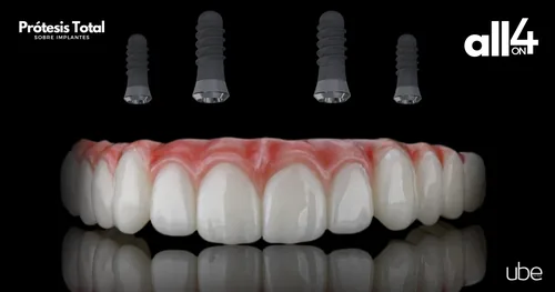 Ube Dental Pabellón Metepec – Dentistas, consultorio dental en Toluca, Estado de México