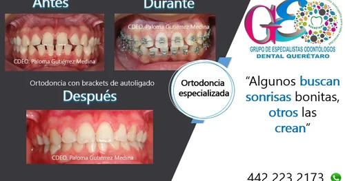 GEO Dental Querétaro – Ortodoncia, Endodoncia, Rehabilitación o Prótesis dental, consultorio dental en Querétaro, Querétaro