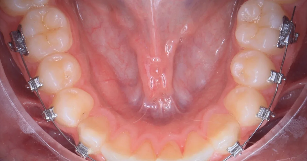Cedenti – tu dentista de confianza