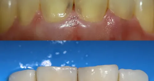 DentalPro SJR, consultorio dental en San Juan del Río, Querétaro