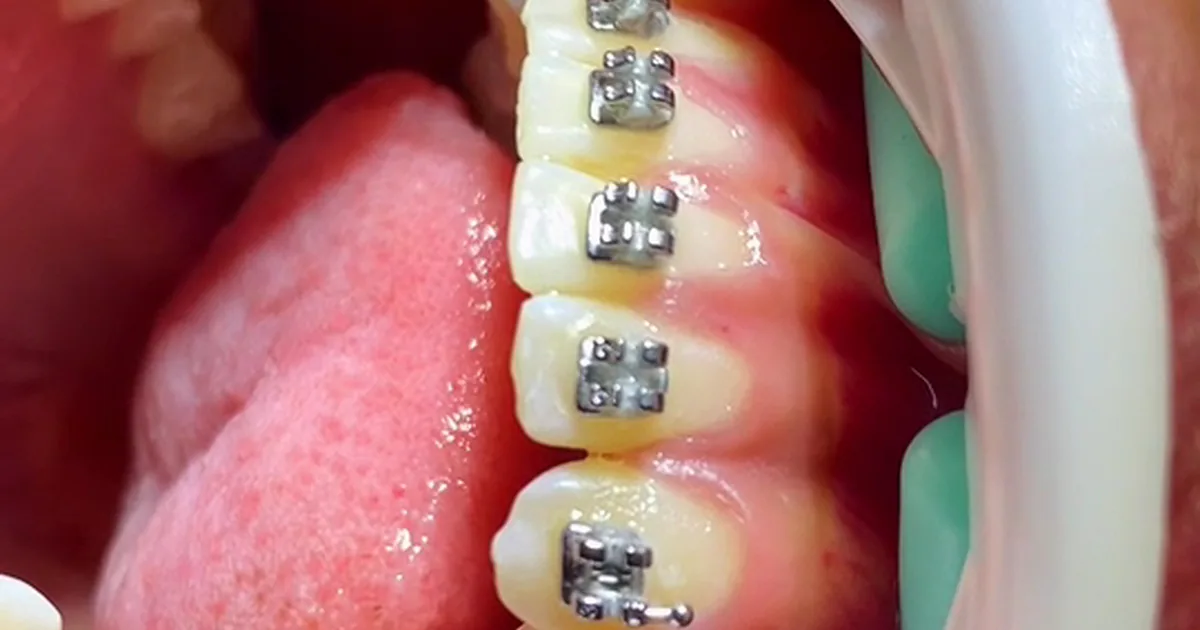 Dental Care Center Tuxtla