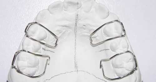 Ortodoncia Dr. Antonio Aguilar Esparza, consultorio dental en Tuxtla Gutiérrez, Chiapas