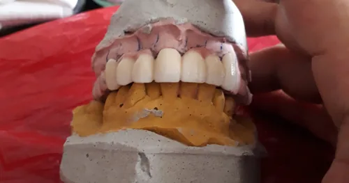 Dental Serrano: Dentista Ortodoncia Cirugía, consultorio dental en Tapachula, Chiapas