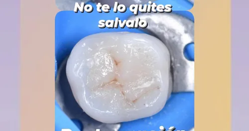 CLÍNICA DENTAL ASIRI EN ACAPULCO, consultorio dental en Acapulco, Guerrero