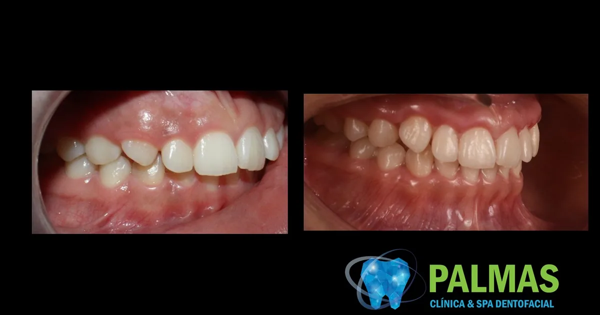 Dentista en Chilpancingo- Clínica Dental Palmas