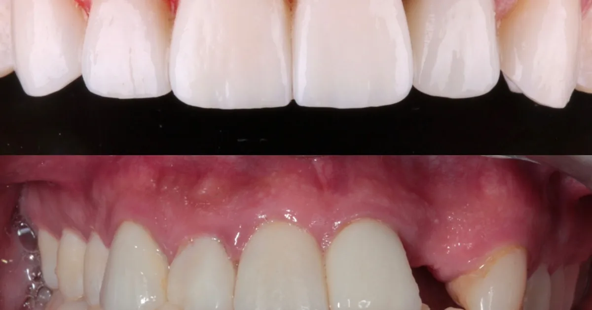 Neosmile